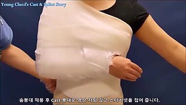 shoulder cast